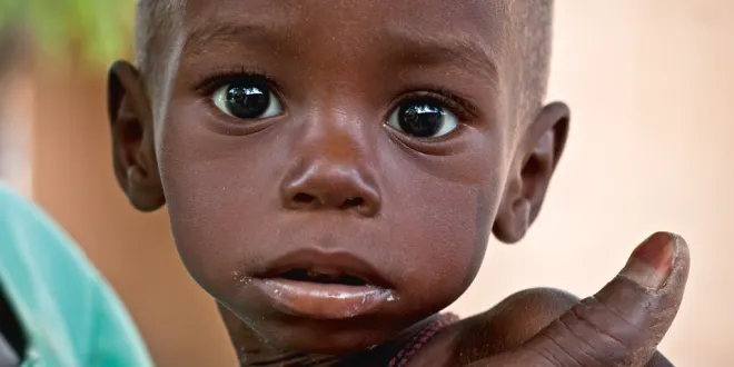 SE-CNSA-Malnutrition au Sénégal : Enfance en souffrance